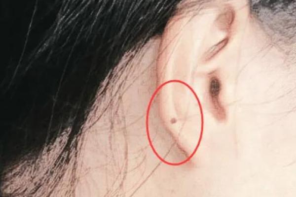 耳朵上有小孔,命运的秘密与生活的启示 耳朵上有小孔,命运的秘密与生活的启示
