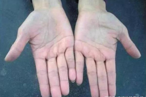 脚背青筋明显，暗示这五种命运特征，你是否中招？