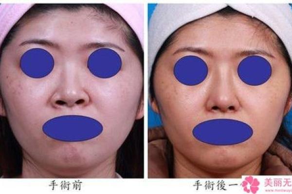 女生鼻子歪是什么命?深度解析与命理探讨! 女生鼻子歪是什么命?深度解析与命理探讨!