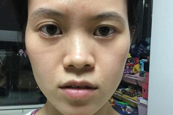 女生鼻子歪是什么命?深度解析与命理探讨! 女生鼻子歪是什么命?深度解析与命理探讨!