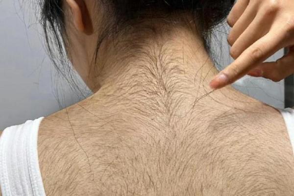 前额毛发旺盛的秘密，你的命运与生俱来的魅力！