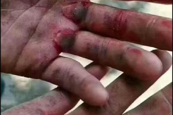 男人手粗糙的命运之谜：您是否也感受到生活的沉重？