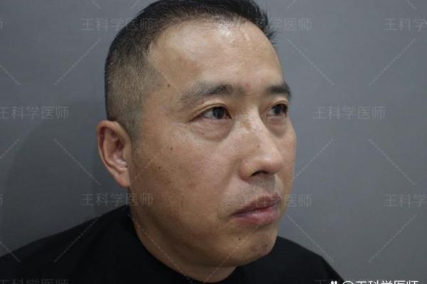 男人有眼袋的命运解析：从面相看运势与人生轨迹