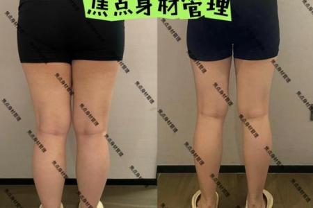 大腿粗的女生命运解析：内外兼修，展现自信之美