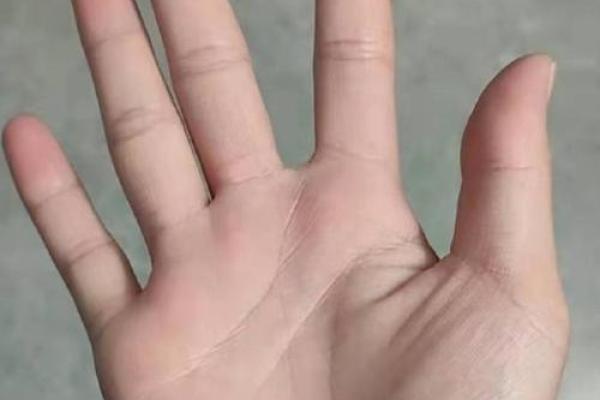 探秘手相线断裂：命运的波折与转机