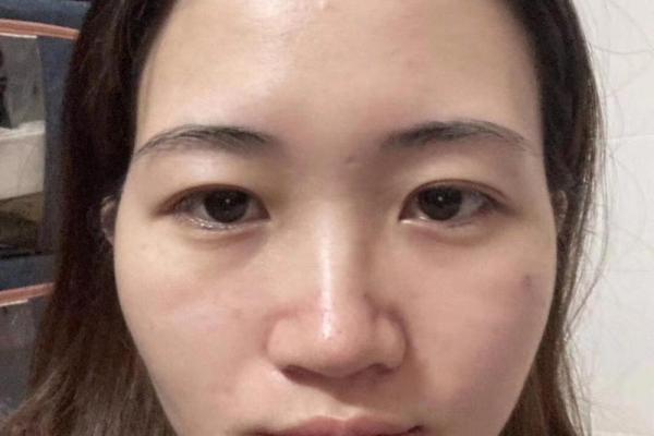 额头宽广的人生轨迹：命运与性格的深刻关联