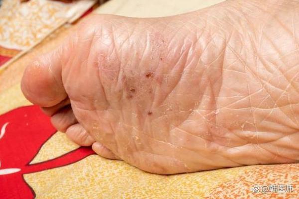 脚心全是皱纹的秘密:揭示命运与健康的深层关联 脚心全是皱纹的秘密:揭示命运与健康的深层关联