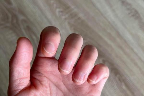 指甲弯曲的秘密：揭示你命运的神秘之钥！