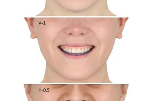 门牙大女生的命运解析:从牙齿看人生的秘密 门牙大女生的命运解析:从牙齿看人生的秘密