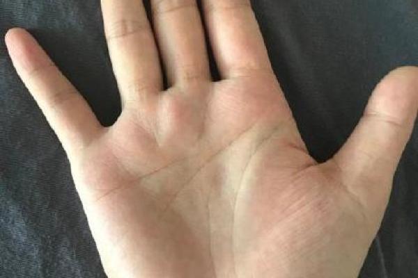 掌心凹陷的人是什么命？探讨手相的奥秘与命运暗示
