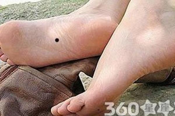 脚底长黑痣：揭示你命运的神秘信号！