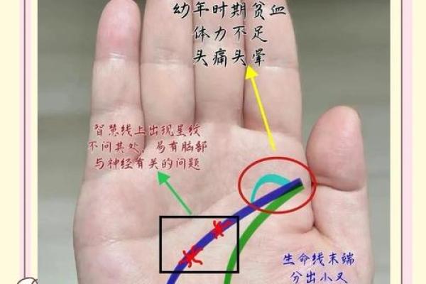 命运的痕迹：解析不良手纹的奥秘与人生启示