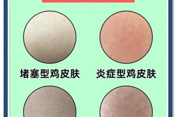有鸡皮肤的人命运揭秘：从皮肤现象看人生走向