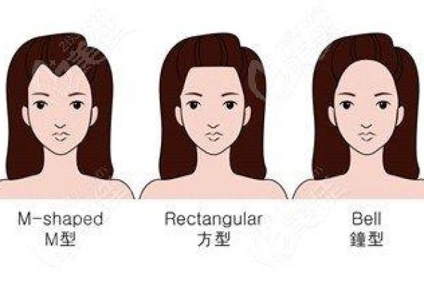从发际线的形状看命运,探索不同发际线的深层含义 从发际线的形状看命运,探索不同发际线的深层含义