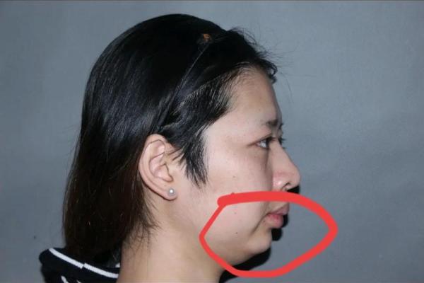 下巴圆润,命运相伴:揭示面相与命运关系的奥秘 下巴圆润,命运相伴:揭示面相与命运关系的奥秘