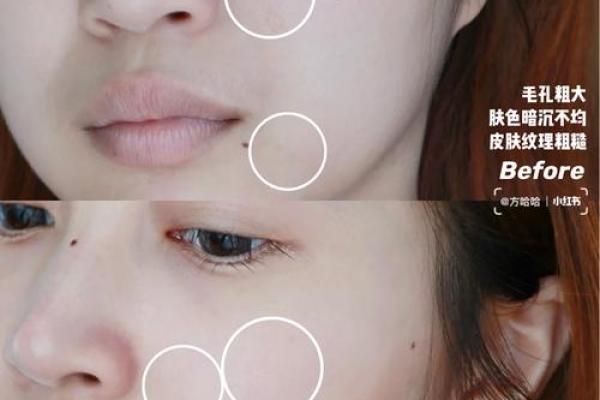 肤色不均揭示命格的秘密:从外貌看内在运势 肤色不均揭示命格的秘密:从外貌看内在运势