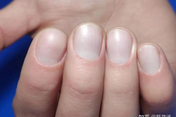 指甲断了的象征意义与命格解析:解读生活中的小细节 指甲断了的象征意义与命格解析:解读生活中的小细节