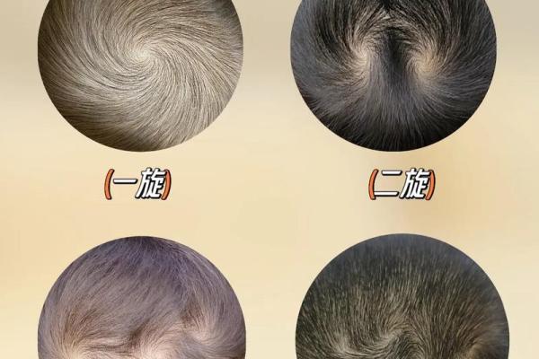 额头特别窄的人命运玄机:探讨命理与性格之间的关系 额头特别窄的人命运玄机:探讨命理与性格之间的关系