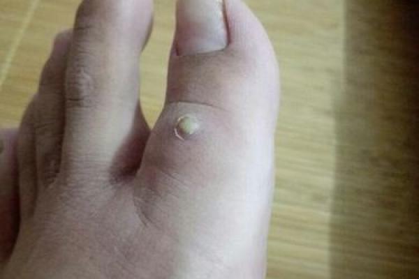 脚拇指向上翘，揭示你命运的秘密！探索身体与命运的奥秘