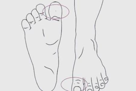 脚趾弯曲的命运：透视你的生活与性格奥秘