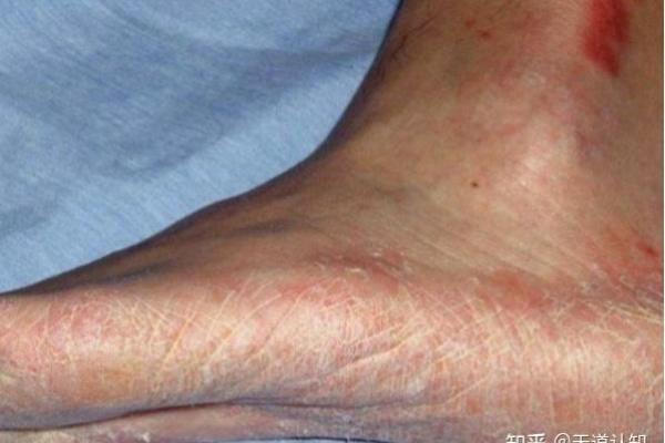 脚趾形状与长短对命运的影响：躲避负能量的秘诀