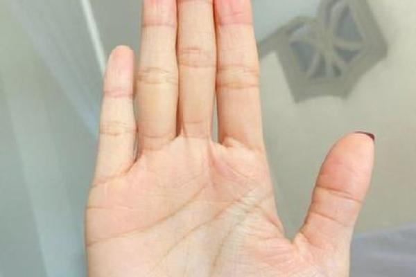 揭开女人眼角有猴子的命运之谜，带你探索其中的奥秘！