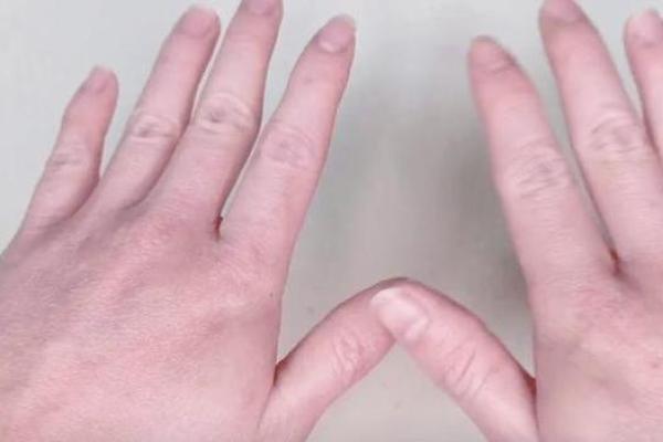 骨节短手指粗的人生命运解读：性格与命运的奇妙关联