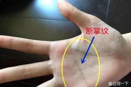 揭开双断掌女孩命运的神秘面纱，探索内心与外界的奇妙联系