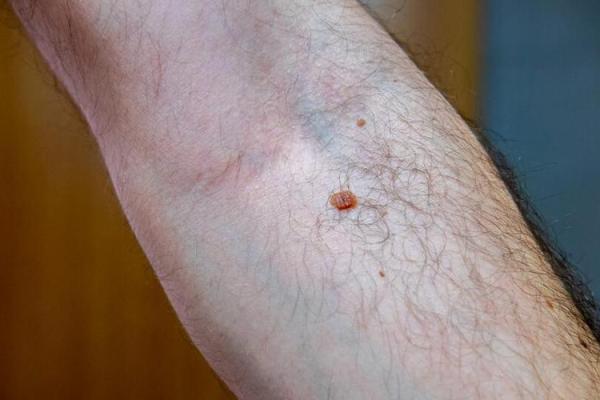 心口有胎记的命运解析：神秘的象征与命理启示