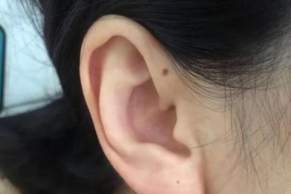 耳垂长的人命运揭秘:你的人生方向可能在这里! 耳垂长的人命运揭秘:你的人生方向可能在这里!