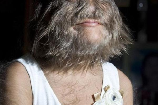 肚脐里面长毛的秘密:揭示身体与命运的神奇关联 肚脐里面长毛的秘密:揭示身体与命运的神奇关联