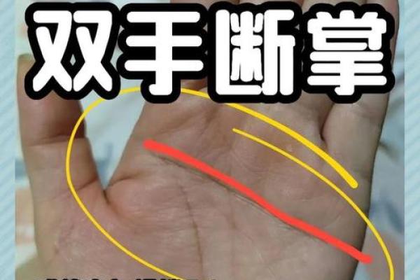 探秘断掌女人的命运:她们拥有怎样的人生轨迹? 探秘断掌女人的命运:她们拥有怎样的人生轨迹?