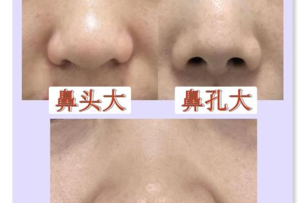 男生鼻子大的命运解析:细看鼻形与性格的神秘联系 男生鼻子大的命运解析:细看鼻形与性格的神秘联系