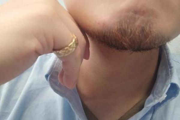 男性胡子稀少的命运:从面相看人生的变化与机遇 男性胡子稀少的命运:从面相看人生的变化与机遇