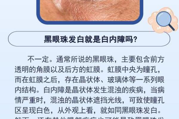 眼睛出现黑点的奥秘与健康警示 眼睛出现黑点的奥秘与健康警示