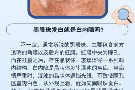 眼睛出现黑点的奥秘与健康警示
