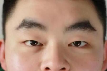 男人乳毛多，命运的隐秘符号？揭开你不了解的真相