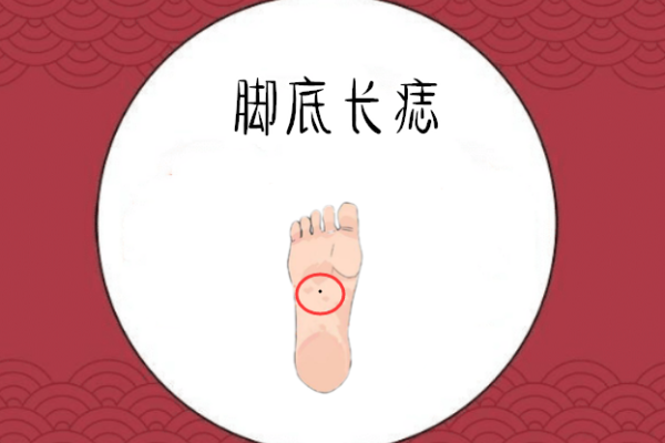 脚底有痣的人命运解析:你的人生暗示与性格特征! 脚底有痣的人命运解析:你的人生暗示与性格特征!