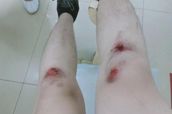 腿上没几根腿毛，究竟是什么命？从容与自信的新解读！