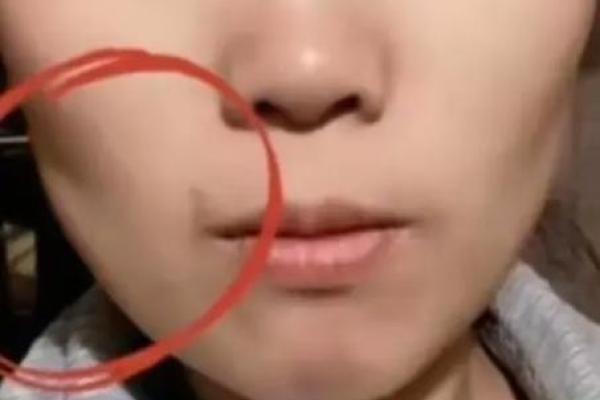 没有脖子的人:独特生命的轮廓与启示 没有脖子的人:独特生命的轮廓与启示