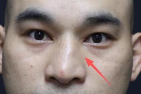 揭秘鼻孔大的命格：他的人生究竟为何如此不同？