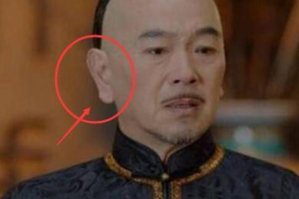 背部肉厚的人命运如何?深度解析与命理的关系 背部肉厚的人命运如何?深度解析与命理的关系