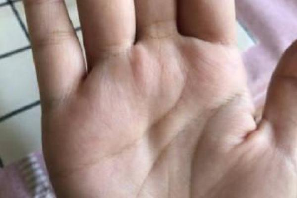 背部肉厚的人命运如何?深度解析与命理的关系 背部肉厚的人命运如何?深度解析与命理的关系